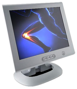Image of knee and body on a monitor