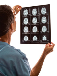 Radiologist reviewing brain scans