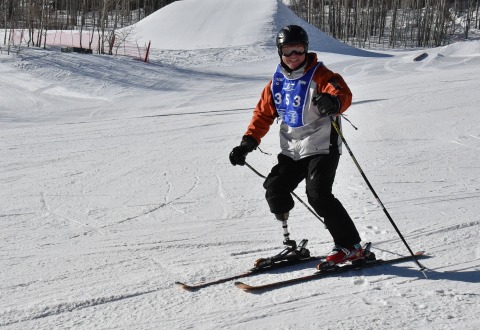 Skier with prosthetic leg on the slopes